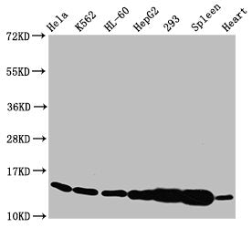 Western Blot  | Positive WB detected in: Hela whole cell lysate, K562 whole cell lysate, HL60 whole cell lysate, HepG2 whole cell lysate, 293 whole cell lysate, Rat spleen tissue, Rat heart tissue  | All lanes: HIST1H2BC antibody at 1.4µg/ml  | Secondary  | Goat polyclonal to rabbit IgG at 1/50000 dilution  | Predicted band size: 14 kDa  | Observed band size: 14 kDaRabbit anti-Human HIST1H2BC Polyclonal Antibody