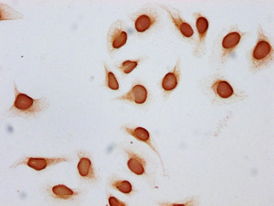 Immunocytochemistry analysis of Acetyl-HIST1H2BC (K12) Antibody diluted at 1:10 and staining in Hela cells (treated with 30mM sodium butyrate for 4h) performed on a Leica BondTM system. The cells were fixed in 4% formaldehyde, permeabilized using 0.2% Triton X-100 and blocked with 10% normal goat serum 30min at RT. Then primary antibody (1% BSA) was incubated at 4°C overnight. The primary is detected by a biotinylated secondary antibody and visualized using an HRP conjugated SP system.Rabbit anti-Human HIST1H2BC Polyclonal Antibody