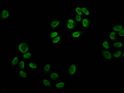 Immunofluorescence staining of Hela cells (treated with 30mM sodium butyrate for 4h) with Acetyl-HIST1H2BC (K12) Antibody at 1:5, counter-stained with DAPI. The cells were fixed in 4% formaldehyde, permeabilized using 0.2% Triton X-100 and blocked in 10% normal Goat Serum. The cells were then incubated with the antibody overnight at 4°C. The secondary antibody was Alexa Fluor 488-congugated AffiniPure Goat Anti-Rabbit IgG(H+L).Rabbit anti-Human HIST1H2BC Polyclonal Antibody