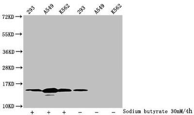Western Blot  | Detected samples: 293 whole cell lysate, A549 whole cell lysate, K562 whole cell lysate; Untreated (-) or treated (+) with 30mM sodium butyrate for 4h  | All lanes: HIST1H2BC antibody at 1:100  | Secondary  | Goat polyclonal to rabbit IgG at 1/50000 dilution  | Predicted band size: 14 kDa  | Observed band size: 14 kDaRabbit anti-Human HIST1H2BC Polyclonal Antibody