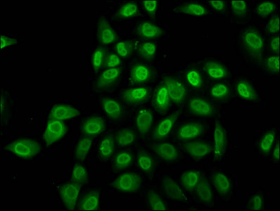 Immunofluorescence staining of Hela cells (treated with 30mM sodium crotonylate for 4h) with Crotonyl-HIST1H2BC (K12) Antibody at 1:5, counter-stained with DAPI. The cells were fixed in 4% formaldehyde, permeabilized using 0.2% Triton X-100 and blocked in 10% normal Goat Serum. The cells were then incubated with the antibody overnight at 4°C. The secondary antibody was Alexa Fluor 488-congugated AffiniPure Goat Anti-Rabbit IgG(H+L).Rabbit anti-Human HIST1H2BC Polyclonal Antibody