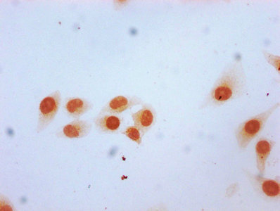 Immunocytochemistry analysis of 2-hydroxyisobutyryl-HIST1H2BC (K12) Antibody diluted at 1:15 and staining in Hela cells (treated with 30mM sodium butyrate for 4h) performed on a Leica BondTM system. The cells were fixed in 4% formaldehyde, permeabilized using 0.2% Triton X-100 and blocked with 10% normal goat serum 30min at RT. Then primary antibody (1% BSA) was incubated at 4°C overnight. The primary is detected by a biotinylated secondary antibody and visualized using an HRP conjugated SP system.Rabbit anti-Human HIST1H2BC Polyclonal Antibody