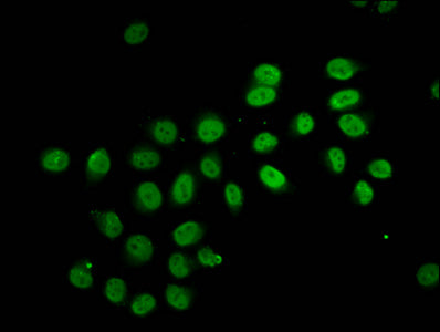 Immunofluorescence staining of Hela cells (treated with 30mM sodium butyrate for 4h) with 2-hydroxyisobutyryl-HIST1H2BC (K12) Antibody at 1:7.5, counter-stained with DAPI. The cells were fixed in 4% formaldehyde, permeabilized using 0.2% Triton X-100 and blocked in 10% normal Goat Serum. The cells were then incubated with the antibody overnight at 4°C. The secondary antibody was Alexa Fluor 488-congugated AffiniPure Goat Anti-Rabbit IgG(H+L).Rabbit anti-Human HIST1H2BC Polyclonal Antibody