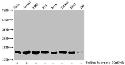 Western Blot  | Detected samples: Hela whole cell lysate, Jurkat whole cell lysate, K562 whole cell lysate, 293 whole cell lysate; Untreated (-) or treated (+) with 30mM sodium butyrate for 4h  | All lanes: HIST1H2BC antibody at 1:500  | Secondary  | Goat polyclonal to rabbit IgG at 1/40000 dilution  | Predicted band size: 14 kDa  | Observed band size: 14 kDaRabbit anti-Human HIST1H2BC Polyclonal Antibody