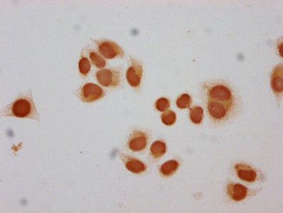 Immunocytochemistry analysis of Mono-methyl-HIST1H2BC (K12) Antibody diluted at 1:30 and staining in Hela cells performed on a Leica BondTM system. The cells were fixed in 4% formaldehyde, permeabilized using 0.2% Triton X-100 and blocked with 10% normal goat serum 30min at RT. Then primary antibody (1% BSA) was incubated at 4°C overnight. The primary is detected by a biotinylated secondary antibody and visualized using an HRP conjugated SP system.Rabbit anti-Human HIST1H2BC Polyclonal Antibody