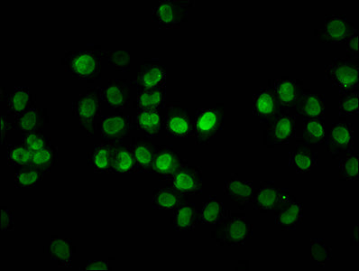Immunofluorescence staining of Hela cells with HIST1H2BC (Ab-12) Antibody at 1:3, counter-stained with DAPI. The cells were fixed in 4% formaldehyde, permeabilized using 0.2% Triton X-100 and blocked in 10% normal Goat Serum. The cells were then incubated with the antibody overnight at 4°C. The secondary antibody was Alexa Fluor 488-congugated AffiniPure Goat Anti-Rabbit IgG(H+L).Rabbit anti-Human HIST1H2BC Polyclonal Antibody