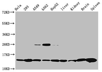 Western Blot  | Positive WB detected in: Hela whole cell lysate, 293 whole cell lysate, A549 whole cell lysate, K562 whole cell lysate, HepG2 whole cell lysate, Rat liver tissue, Rat kidney tissue, Mouse brain tissue, Mouse spleen tissue  | All lanes: HIST1H2BC antibody at 0.47µg/ml  | Secondary  | Goat polyclonal to rabbit IgG at 1/50000 dilution  | Predicted band size: 14 kDa  | Observed band size: 14 kDaRabbit anti-Human HIST1H2BC Polyclonal Antibody
