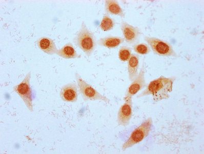 Immunocytochemistry analysis of Crotonyl-HIST1H2BC (K16) Antibody diluted at 1:25 and staining in Hela cells (treated with 30mM sodium crotonylate for 4h) performed on a Leica BondTM system. The cells were fixed in 4% formaldehyde, permeabilized using 0.2% Triton X-100 and blocked with 10% normal goat serum 30min at RT. Then primary antibody (1% BSA) was incubated at 4°C overnight. The primary is detected by a biotinylated secondary antibody and visualized using an HRP conjugated SP system.Rabbit anti-Human HIST1H2BC Polyclonal Antibody
