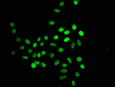 Immunofluorescence staining of Hela cells (treated with 30mM sodium crotonylate for 4h) with Crotonyl-HIST1H2BC (K16) Antibody at 1:12.5, counter-stained with DAPI. The cells were fixed in 4% formaldehyde, permeabilized using 0.2% Triton X-100 and blocked in 10% normal Goat Serum. The cells were then incubated with the antibody overnight at 4°C. The secondary antibody was Alexa Fluor 488-congugated AffiniPure Goat Anti-Rabbit IgG(H+L).Rabbit anti-Human HIST1H2BC Polyclonal Antibody