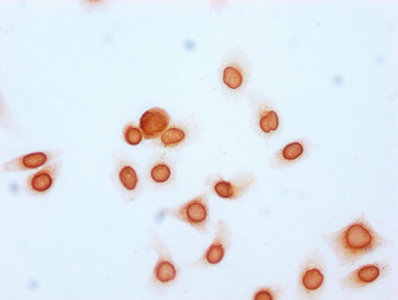 Immunocytochemistry analysis of Acetyl-HIST1H2BC (K20) Antibody diluted at 1:15 and staining in Hela cells (treated with 30mM sodium butyrate for 4h) performed on a Leica BondTM system. The cells were fixed in 4% formaldehyde, permeabilized using 0.2% Triton X-100 and blocked with 10% normal goat serum 30min at RT. Then primary antibody (1% BSA) was incubated at 4°C overnight. The primary is detected by a biotinylated secondary antibody and visualized using an HRP conjugated SP system.Rabbit anti-Human HIST1H2BC Polyclonal Antibody