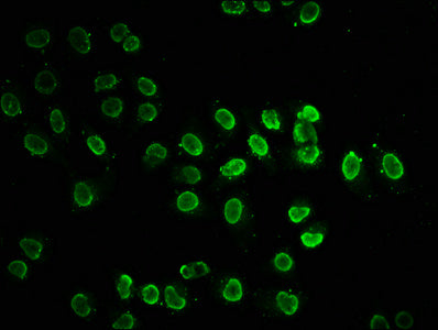 Immunofluorescence staining of Hela cells (treated with 30mM sodium butyrate for 4h) with Acetyl-HIST1H2BC (K20) Antibody at 1:7.5, counter-stained with DAPI. The cells were fixed in 4% formaldehyde, permeabilized using 0.2% Triton X-100 and blocked in 10% normal Goat Serum. The cells were then incubated with the antibody overnight at 4°C. The secondary antibody was Alexa Fluor 488-congugated AffiniPure Goat Anti-Rabbit IgG(H+L).Rabbit anti-Human HIST1H2BC Polyclonal Antibody