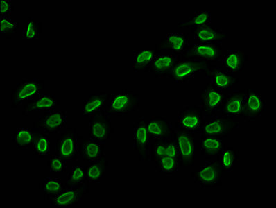 Immunofluorescence staining of Hela cells (treated with 30mM sodium butyrate for 4h) with Butyrly-HIST1H2BC (K20) Antibody at 1:15, counter-stained with DAPI. The cells were fixed in 4% formaldehyde, permeabilized using 0.2% Triton X-100 and blocked in 10% normal Goat Serum. The cells were then incubated with the antibody overnight at 4°C. The secondary antibody was Alexa Fluor 488-congugated AffiniPure Goat Anti-Rabbit IgG(H+L).Rabbit anti-Human HIST1H2BC Polyclonal Antibody