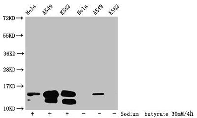Western Blot  | Detected samples: Hela whole cell lysate, A549 whole cell lysate, K562 whole cell lysate; Untreated (-) or treated (+) with 30mM sodium butyrate for 4h  | All lanes: HIST1H2BC antibody at 1:100  | Secondary  | Goat polyclonal to rabbit IgG at 1/50000 dilution  | Predicted band size: 14 kDa  | Observed band size: 14 kDaRabbit anti-Human HIST1H2BC Polyclonal Antibody