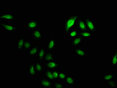 Immunofluorescence staining of Hela cells (treated with 30mM sodium crotonylate for 4h) with Crotonyl-HIST1H2BC (K20) Antibody at 1:12.5, counter-stained with DAPI. The cells were fixed in 4% formaldehyde, permeabilized using 0.2% Triton X-100 and blocked in 10% normal Goat Serum. The cells were then incubated with the antibody overnight at 4°C. The secondary antibody was Alexa Fluor 488-congugated AffiniPure Goat Anti-Rabbit IgG(H+L).Rabbit anti-Human HIST1H2BC Polyclonal Antibody