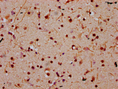 IHC image of HIST1H2BC (Ab-20) Antibody diluted at 1:10 and staining in paraffin-embedded human brain tissue performed on a Leica BondTM system. After dewaxing and hydration, antigen retrieval was mediated by high pressure in a citrate buffer (pH 6.0). Section was blocked with 10% normal goat serum 30min at RT. Then primary antibody (1% BSA) was incubated at 4°C overnight. The primary is detected by a biotinylated secondary antibody and visualized using an HRP conjugated SP system.Rabbit anti-Human HIST1H2BC Polyclonal Antibody