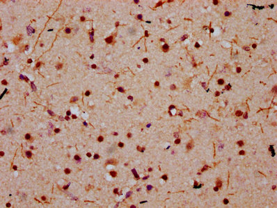 IHC image of HIST1H2BC (Ab-20) Antibody diluted at 1:10 and staining in paraffin-embedded human brain tissue performed on a Leica BondTM system. After dewaxing and hydration, antigen retrieval was mediated by high pressure in a citrate buffer (pH 6.0). Section was blocked with 10% normal goat serum 30min at RT. Then primary antibody (1% BSA) was incubated at 4°C overnight. The primary is detected by a biotinylated secondary antibody and visualized using an HRP conjugated SP system.Rabbit anti-Human HIST1H2BC Polyclonal Antibody