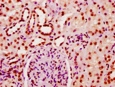 IHC image of HIST1H2BC (Ab-20) Antibody diluted at 1:10 and staining in paraffin-embedded human kidney tissue performed on a Leica BondTM system. After dewaxing and hydration, antigen retrieval was mediated by high pressure in a citrate buffer (pH 6.0). Section was blocked with 10% normal goat serum 30min at RT. Then primary antibody (1% BSA) was incubated at 4°C overnight. The primary is detected by a biotinylated secondary antibody and visualized using an HRP conjugated SP system.Rabbit anti-Human HIST1H2BC Polyclonal Antibody