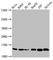 Western Blot  | Positive WB detected in: Hela whole cell lysate, K562 whole cell lysate, HL60 whole cell lysate, HepG2 whole cell lysate, 293 whole cell lysate, Rat spleen tissue  | All lanes: HIST1H2BC antibody at 0.33µg/ml  | Secondary  | Goat polyclonal to rabbit IgG at 1/50000 dilution  | Predicted band size: 14 kDa  | Observed band size: 14 kDaRabbit anti-Human HIST1H2BC Polyclonal Antibody