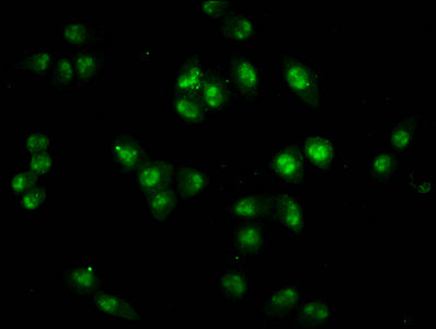 Immunofluorescence staining of Hela cells with HIST1H2BC (Ab-20) Antibody at 1:1, counter-stained with DAPI. The cells were fixed in 4% formaldehyde, permeabilized using 0.2% Triton X-100 and blocked in 10% normal Goat Serum. The cells were then incubated with the antibody overnight at 4°C. The secondary antibody was Alexa Fluor 488-congugated AffiniPure Goat Anti-Rabbit IgG(H+L).Rabbit anti-Human HIST1H2BC Polyclonal Antibody