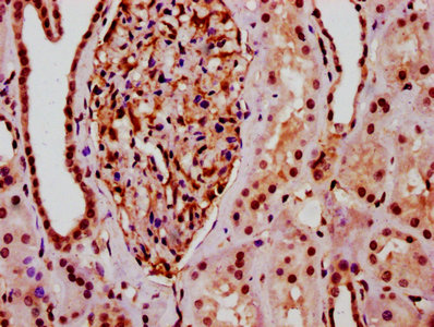 IHC image of HIST1H2BC (Ab-20) Antibody diluted at 1:10 and staining in paraffin-embedded human kidney tissue performed on a Leica BondTM system. After dewaxing and hydration, antigen retrieval was mediated by high pressure in a citrate buffer (pH 6.0). Section was blocked with 10% normal goat serum 30min at RT. Then primary antibody (1% BSA) was incubated at 4°C overnight. The primary is detected by a biotinylated secondary antibody and visualized using an HRP conjugated SP system.Rabbit anti-Human HIST1H2BC Polyclonal Antibody