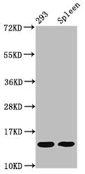 Western Blot  | Positive WB detected in: 293 whole cell lysate, Mouse spleen tissue  | All lanes: HIST1H2BC antibody at 0.09µg/ml  | Secondary  | Goat polyclonal to rabbit IgG at 1/50000 dilution  | Predicted band size: 14 kDa  | Observed band size: 14 kDaRabbit anti-Human HIST1H2BC Polyclonal Antibody