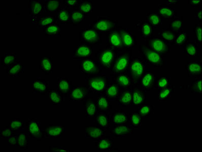 Immunofluorescence staining of Hela cells (treated with 30mM sodium crotonylate for 4h) with the antibody at 1:37.5, counter-stained with DAPI. The cells were fixed in 4% formaldehyde, permeabilized using 0.2% Triton X-100 and blocked in 10% normal Goat Serum. The cells were then incubated with the antibody overnight at 4°C. The secondary antibody was Alexa Fluor 488-congugated AffiniPure Goat Anti-Rabbit IgG(H+L).Rabbit anti-Human HIST1H2BC Polyclonal Antibody