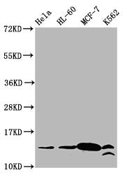 Western Blot  | Positive WB detected in: Hela whole cell lysate, HL60 whole cell lysate, MCF-7 whole cell lysate, K562 whole cell lysate  | All lanes: HIST1H2BC antibody at 1.8μg/ml  | Secondary  | Goat polyclonal to rabbit IgG at 1/50000 dilution  | Predicted band size: 14 kDa  | Observed band size: 14 kDaRabbit anti-Human HIST1H2BC Polyclonal Antibody