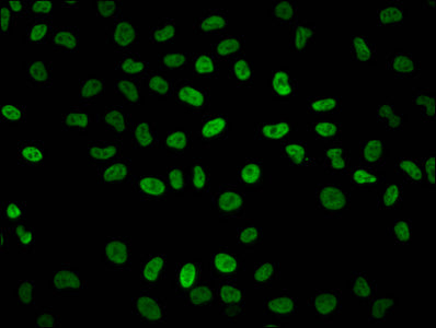 Immunofluorescence staining of Hela cells with HIST1H2BC (Ab-23) Antibody at 1:1, counter-stained with DAPI. The cells were fixed in 4% formaldehyde, permeabilized using 0.2% Triton X-100 and blocked in 10% normal Goat Serum. The cells were then incubated with the antibody overnight at 4°C. The secondary antibody was Alexa Fluor 488-congugated AffiniPure Goat Anti-Rabbit IgG(H+L).Rabbit anti-Human HIST1H2BC Polyclonal Antibody