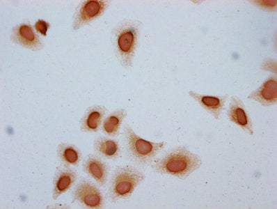 Immunocytochemistry analysis of Acetyl-HIST1H2BC (K24) Antibody diluted at 1:10 and staining in Hela cells (treated with 30mM sodium butyrate for 4h) performed on a Leica BondTM system. The cells were fixed in 4% formaldehyde, permeabilized using 0.2% Triton X-100 and blocked with 10% normal goat serum 30min at RT. Then primary antibody (1% BSA) was incubated at 4°C overnight. The primary is detected by a biotinylated secondary antibody and visualized using an HRP conjugated SP system.Rabbit anti-Human HIST1H2BC Polyclonal Antibody