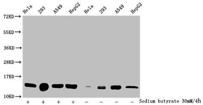 Western Blot  | Detected samples: Hela whole cell lysate, 293 whole cell lysate, A549 whole cell lysate, HepG2 whole cell lysate; Untreated (-) or treated (+) with 30mM sodium butyrate for 4h  | All lanes: HIST1H2BC antibody at 1:100  | Secondary  | Goat polyclonal to rabbit IgG at 1/50000 dilution  | Predicted band size: 14 kDa  | Observed band size: 14 kDaRabbit anti-Human HIST1H2BC Polyclonal Antibody