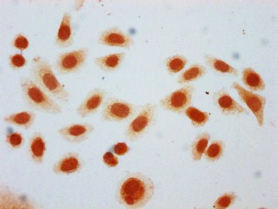 Immunocytochemistry analysis of 2-hydroxyisobutyryl-HIST1H2BC (K24) Antibody diluted at 1:25 and staining in Hela cells (treated with 30mM sodium butyrate for 4h) performed on a Leica BondTM system. The cells were fixed in 4% formaldehyde, permeabilized using 0.2% Triton X-100 and blocked with 10% normal goat serum 30min at RT. Then primary antibody (1% BSA) was incubated at 4°C overnight. The primary is detected by a biotinylated secondary antibody and visualized using an HRP conjugated SP system.Rabbit anti-Human HIST1H2BC Polyclonal Antibody