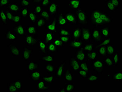 Immunofluorescence staining of Hela cells (treated with 30mM sodium butyrate for 4h) with 2-hydroxyisobutyryl-HIST1H2BC (K24) Antibody at 1:12.5, counter-stained with DAPI. The cells were fixed in 4% formaldehyde, permeabilized using 0.2% Triton X-100 and blocked in 10% normal Goat Serum. The cells were then incubated with the antibody overnight at 4°C. The secondary antibody was Alexa Fluor 488-congugated AffiniPure Goat Anti-Rabbit IgG(H+L).Rabbit anti-Human HIST1H2BC Polyclonal Antibody