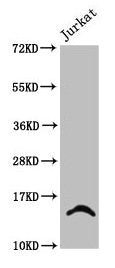 Western Blot  | Positive WB detected in: Jurkat whole cell lysate (treated with 30mM sodium butyrate for 4h)  | All lanes: HIST1H2BC antibody at 2.4µg/ml  | Secondary  | Goat polyclonal to rabbit IgG at 1/50000 dilution  | Predicted band size: 14 kDa  | Observed band size: 14 kDaRabbit anti-Human HIST1H2BC Polyclonal Antibody