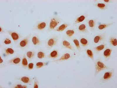 Immunocytochemistry analysis of 2-hydroxyisobutyryl-HIST1H2BC (K34) Antibody diluted at 1:10 and staining in Hela cells (treated with 30mM sodium butyrate for 4h) performed on a Leica BondTM system. The cells were fixed in 4% formaldehyde, permeabilized using 0.2% Triton X-100 and blocked with 10% normal goat serum 30min at RT. Then primary antibody (1% BSA) was incubated at 4°C overnight. The primary is detected by a biotinylated secondary antibody and visualized using an HRP conjugated SP system.Rabbit anti-Human HIST1H2BC Polyclonal Antibody