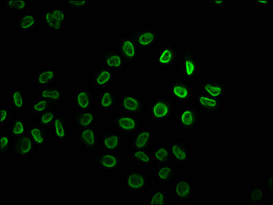 Immunofluorescence staining of Hela cells (treated with 30mM sodium butyrate for 4h) with 2-hydroxyisobutyryl-HIST1H2BC (K34) Antibody at 1:5, counter-stained with DAPI. The cells were fixed in 4% formaldehyde, permeabilized using 0.2% Triton X-100 and blocked in 10% normal Goat Serum. The cells were then incubated with the antibody overnight at 4°C. The secondary antibody was Alexa Fluor 488-congugated AffiniPure Goat Anti-Rabbit IgG(H+L).Rabbit anti-Human HIST1H2BC Polyclonal Antibody