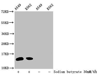 Western Blot  | Detected samples: A549 whole cell lysate, K562 whole cell lysate; Untreated (-) or treated (+) with 30mM sodium butyrate for 4h  | All lanes: HIST1H2BC antibody at 1:100  | Secondary  | Goat polyclonal to rabbit IgG at 1/50000 dilution  | Predicted band size: 14 kDa  | Observed band size: 14 kDaRabbit anti-Human HIST1H2BC Polyclonal Antibody