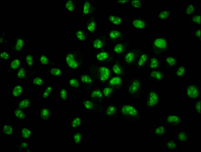 Immunofluorescence staining of Hela cells with HIST1H2BC (Ab-34) Antibody at 1:1, counter-stained with DAPI. The cells were fixed in 4% formaldehyde, permeabilized using 0.2% Triton X-100 and blocked in 10% normal Goat Serum. The cells were then incubated with the antibody overnight at 4°C. The secondary antibody was Alexa Fluor 488-congugated AffiniPure Goat Anti-Rabbit IgG(H+L).Rabbit anti-Human HIST1H2BC Polyclonal Antibody