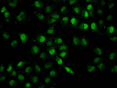 Immunofluorescence staining of Hela cells with HIST1H2BC (Ab-79) Antibody at 1:1.25, counter-stained with DAPI. The cells were fixed in 4% formaldehyde, permeabilized using 0.2% Triton X-100 and blocked in 10% normal Goat Serum. The cells were then incubated with the antibody overnight at 4°C. The secondary antibody was Alexa Fluor 488-congugated AffiniPure Goat Anti-Rabbit IgG(H+L).Rabbit anti-Human HIST1H2BC Polyclonal Antibody