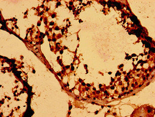 Immunohistochemistry of paraffin-embedded human testis tissue using HIST1H2BK Antibody at dilution of 1:100Rabbit anti-Human HIST1H2BK Polyclonal Antibody