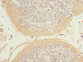 Immunohistochemistry of paraffin-embedded human tonsil tissue using HIST1H3A Antibody at dilution of 1:100Rabbit anti-Human HIST1H3A Polyclonal Antibody