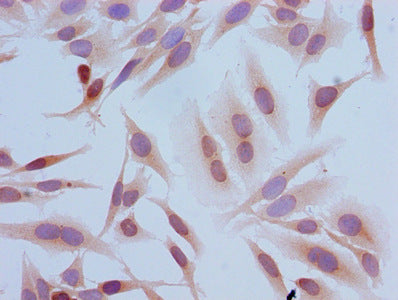 Immunocytochemistry analysis of Hela cells using Tri-methyl-HIST1H3A (K4) Antibody at dilution of 1:100Rabbit anti-Human HIST1H3A Polyclonal Antibody