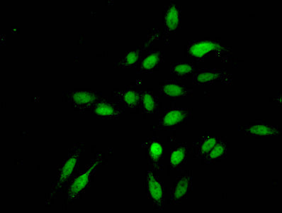 Immunofluorescent analysis of Hela cells using Tri-methyl-HIST1H3A (K4) Antibody at dilution of 1:100 and Alexa Fluor 488-congugated AffiniPure Goat Anti-Rabbit IgG(H+L)Rabbit anti-Human HIST1H3A Polyclonal Antibody