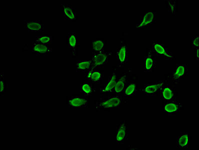 Immunofluorescent analysis of Hela cells using HIST1H3A (Ab-4) Antibody at dilution of 1:100 and Alexa Fluor 488-congugated AffiniPure Goat Anti-Rabbit IgG(H+L)Rabbit anti-Human HIST1H3A Polyclonal Antibody