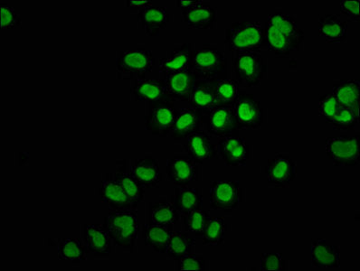 Immunofluorescence staining of Hela cells with HIST1H3A (Ab-3) Antibody at 1:1, counter-stained with DAPI. The cells were fixed in 4% formaldehyde, permeabilized using 0.2% Triton X-100 and blocked in 10% normal Goat Serum. The cells were then incubated with the antibody overnight at 4°C. The secondary antibody was Alexa Fluor 488-congugated AffiniPure Goat Anti-Rabbit IgG(H+L).Rabbit anti-Human HIST1H3A Polyclonal Antibody
