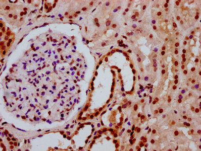IHC image of HIST1H3A (Ab-3) Antibody diluted at 1:20 and staining in paraffin-embedded human kidney tissue performed on a Leica BondTM system. After dewaxing and hydration, antigen retrieval was mediated by high pressure in a citrate buffer (pH 6.0). Section was blocked with 10% normal goat serum 30min at RT. Then primary antibody (1% BSA) was incubated at 4°C overnight. The primary is detected by a biotinylated secondary antibody and visualized using an HRP conjugated SP system.Rabbit anti-Human HIST1H3A Polyclonal Antibody