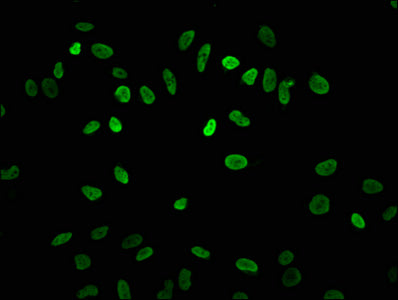 Immunofluorescence staining of Hela cells with the antibody at 1:7.5, counter-stained with DAPI. The cells were fixed in 4% formaldehyde, permeabilized using 0.2% Triton X-100 and blocked in 10% normal Goat Serum. The cells were then incubated with the antibody overnight at 4°C. The secondary antibody was Alexa Fluor 488-congugated AffiniPure Goat Anti-Rabbit IgG(H+L).Rabbit anti-Human HIST1H3A Polyclonal Antibody