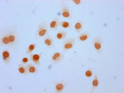 Immunocytochemistry analysis of 2-hydroxyisobutyryl-HIST1H3A (K4) Antibody diluted at 1:40 and staining in Hela cells (treated with 30mM sodium butyrate for 4h) performed on a Leica BondTM system. The cells were fixed in 4% formaldehyde, permeabilized using 0.2% Triton X-100 and blocked with 10% normal goat serum 30min at RT. Then primary antibody (1% BSA) was incubated at 4°C overnight. The primary is detected by a biotinylated secondary antibody and visualized using an HRP conjugated SP system.Rabbit anti-Human HIST1H3A Polyclonal Antibody