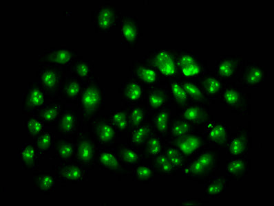 Immunofluorescence staining of Hela cells (treated with 30mM sodium butyrate for 4h) with 2-hydroxyisobutyryl-HIST1H3A (K4) Antibody at 1:20, counter-stained with DAPI. The cells were fixed in 4% formaldehyde, permeabilized using 0.2% Triton X-100 and blocked in 10% normal Goat Serum. The cells were then incubated with the antibody overnight at 4°C. The secondary antibody was Alexa Fluor 488-congugated AffiniPure Goat Anti-Rabbit IgG(H+L).Rabbit anti-Human HIST1H3A Polyclonal Antibody