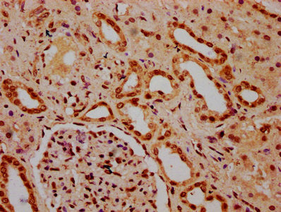 IHC image of HIST1H3A (Ab-4) Antibody diluted at 1:20 and staining in paraffin-embedded human kidney tissue performed on a Leica BondTM system. After dewaxing and hydration, antigen retrieval was mediated by high pressure in a citrate buffer (pH 6.0). Section was blocked with 10% normal goat serum 30min at RT. Then primary antibody (1% BSA) was incubated at 4°C overnight. The primary is detected by a biotinylated secondary antibody and visualized using an HRP conjugated SP system.Rabbit anti-Human HIST1H3A Polyclonal Antibody