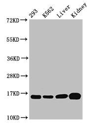 Western Blot  | Positive WB detected in: 293 whole cell lysate, K562 whole cell lysate, Rat liver tissue, Mouse kidney tissue  | All lanes: HIST1H3A antibody at 0.52µg/ml  | Secondary  | Goat polyclonal to rabbit IgG at 1/50000 dilution  | Predicted band size: 16 kDa  | Observed band size: 16 kDaRabbit anti-Human HIST1H3A Polyclonal Antibody